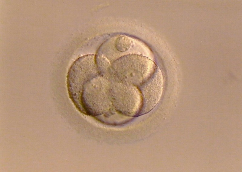 Mikroskopaufnahme einer befruchteten Eizelle